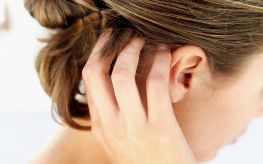 Dermatite seborroica cuoio capelluto e capelli: come scegliere lo shampoo?
